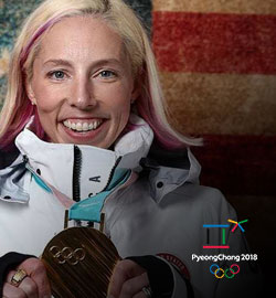 Olympic gold medalist Kikkan Randall asks: Do you let internal competition destroy your team dynamic?